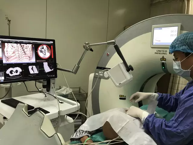 IQQA-Guide三維影像術中導航系統獲創新醫械特別審批，推動精準醫療新發展